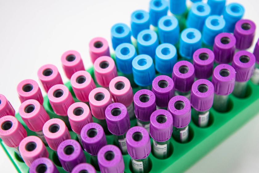 Empty sample tubes on a green holder. Tubes have purple, light red and light blue caps. 