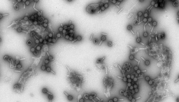 Bakteriofageja mikroskoopilla kuvattuna 