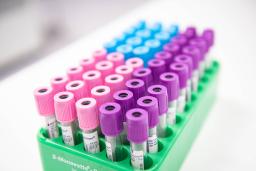 Kuvassa on Jorvin sairaalan laboratorion putkiloita.