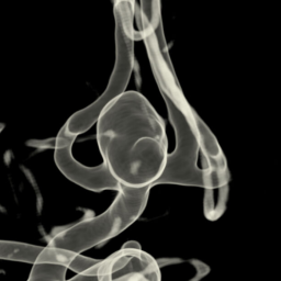 Aivoaneurysma 3D-kuvassa.