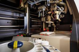 Kohdunkaulasyövän näytteiden analysointia