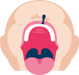 Huulihalkio